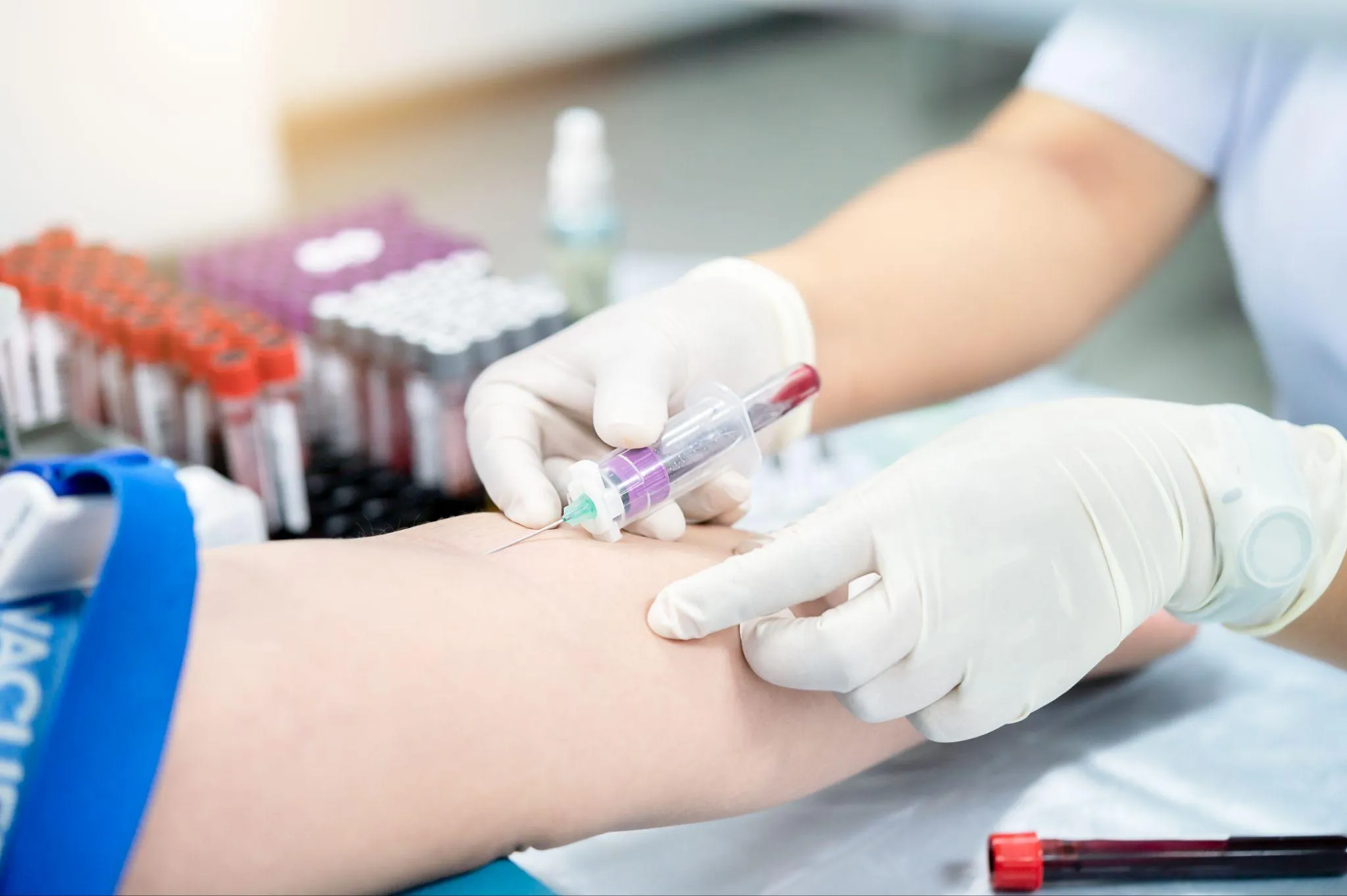 血液検査を受ける際の注意点