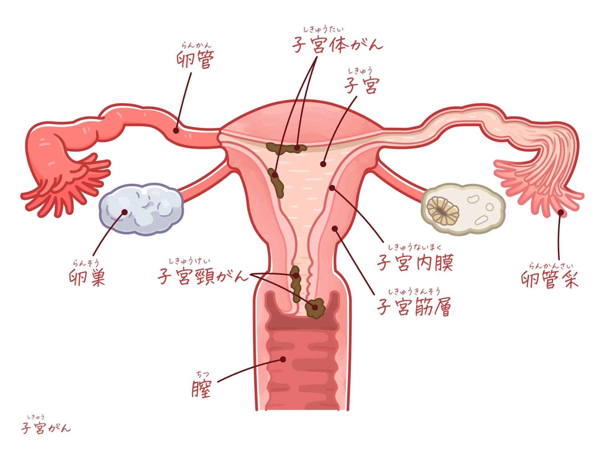 妊婦健診で子宮頸がん検診を受ける理由